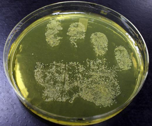 The bacterial species responsible for causing tuberculosis is slow-growing and resistant to treatment.